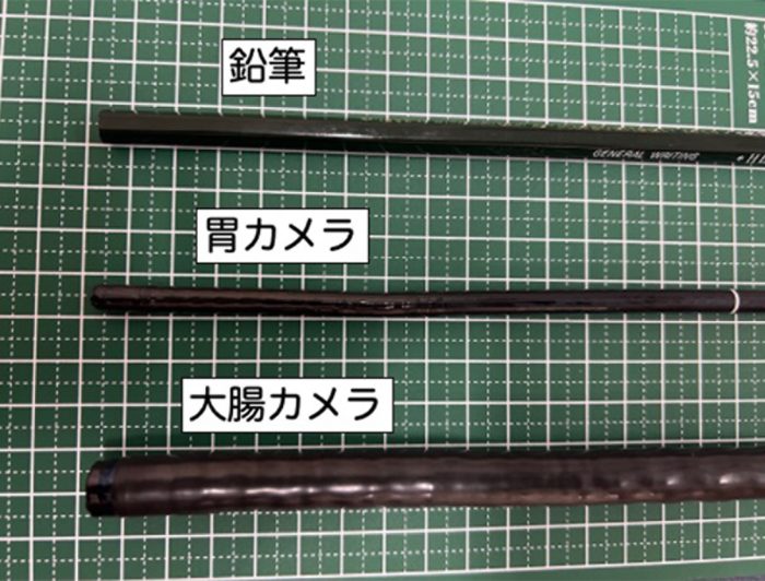内視鏡比較　上から